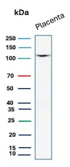 E-Cadherin Antibody (rCDH1/7352) Western Blot: E-Cadherin Antibody (rCDH1/7352) [NBP3-20537] -