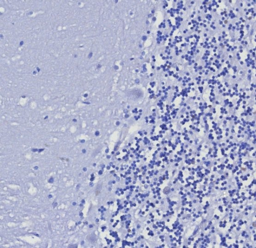 Cytokeratin 5/6 Antibody (KRT5.6/8275R)
