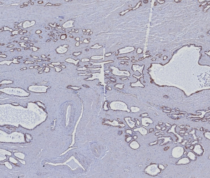 Cytokeratin 5/6 Antibody (KRT5.6/8275R)