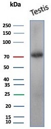 KIF2C Antibody (KIF2C/4704)