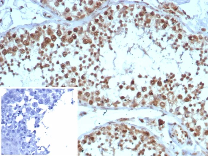 KIF2C Antibody (KIF2C/4705) Immunohistochemistry-Paraffin: KIF2C Antibody (KIF2C/4705) [NBP3-20540] -