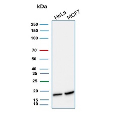 NM23-H2/NME2 Antibody (NME2/6435) Western Blot: NM23-H2/NME2 Antibody (NME2/6435) [NBP3-20542] -