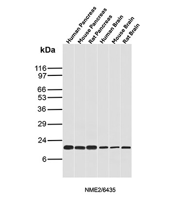 NM23-H2/NME2 Antibody (NME2/6435) Western Blot: NM23-H2/NME2 Antibody (NME2/6435) [NBP3-20542] -