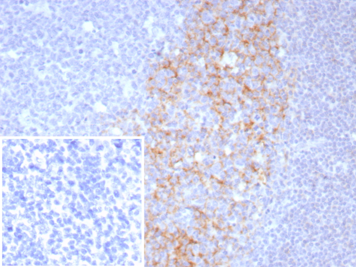 CD23/Fc epsilon RII Antibody (FCER2/8511R)