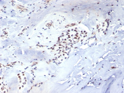 Brachyury Antibody (TBXT/7711R)
