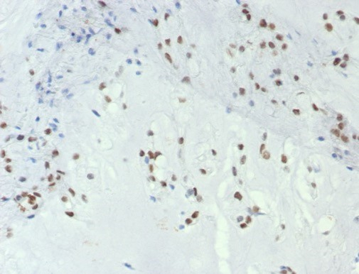 Brachyury Antibody (TBXT/7853R)