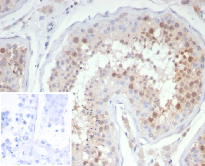 KIF2C Antibody (KIF2C/4706)