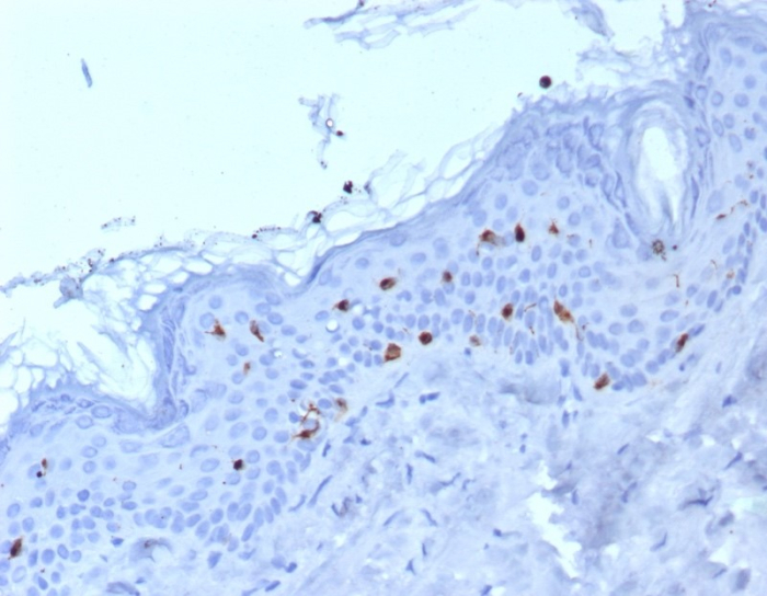 Langerin/CD207 Antibody (LGRN/7430)