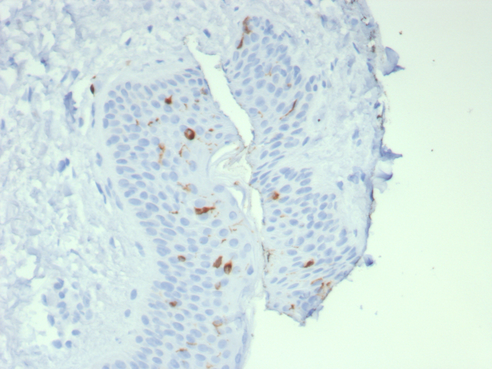 Langerin/CD207 Antibody (LGRN/7541)