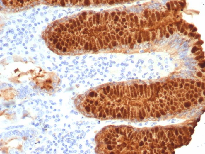 TFF1/pS2 Antibody (TFF1/7768)