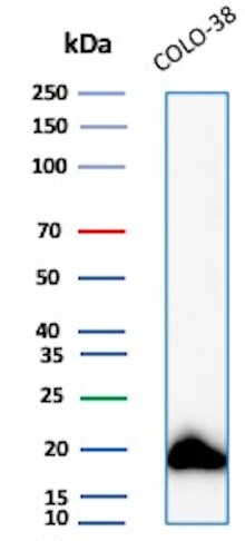 Melan-A/MART-1 Antibody (MLANA/8108R) Western Blot: Melan-A/MART-1 Antibody (MLANA/8108R) [NBP3-20565] -