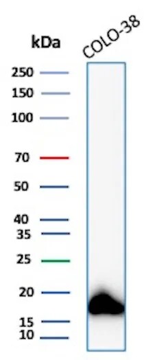 Melan-A/MART-1 Antibody (MLANA/8108R) Western Blot: Melan-A/MART-1 Antibody (MLANA/8108R) [NBP3-20565] -