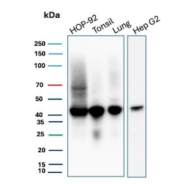 HLA ABC Antibody (MHC-I/8366R) Western Blot: HLA ABC Antibody (MHC-I/8366R) [NBP3-20580] -