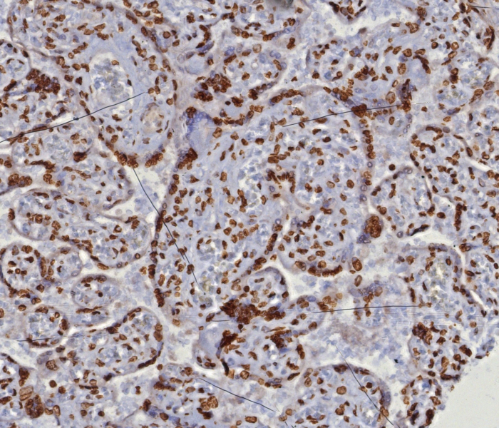 dsDNA Antibody (DSD/8204R)