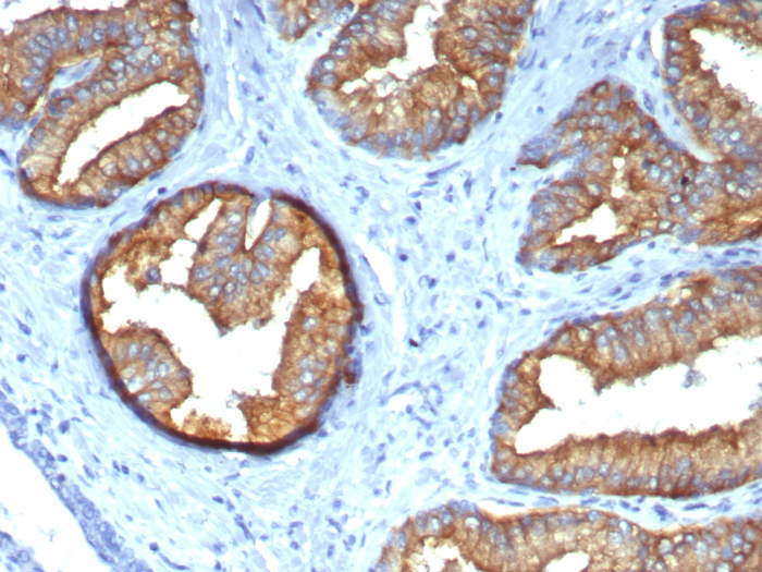 beta Tubulin Antibody (TUBB/4470)