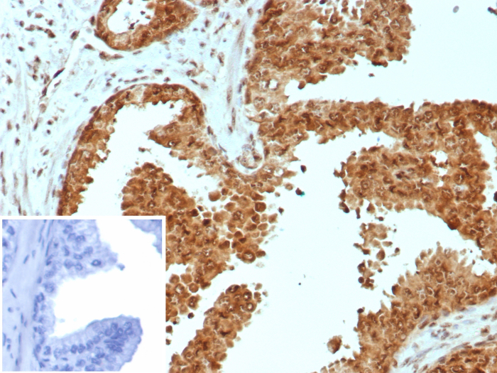 Carm1 Antibody (CARM1/7426)