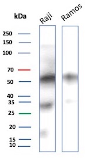 CD27/TNFRSF7 Antibody (LPFS2/8574R) Western Blot: CD27/TNFRSF7 Antibody (LPFS2/8574R) [NBP3-20596] -