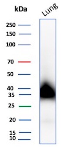 Podoplanin Antibody (rPDPN/6994) Western Blot: Podoplanin Antibody (rPDPN/6994) [NBP3-20603] -