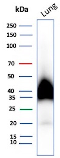 Podoplanin Antibody (PDPN/7808R) Western Blot: Podoplanin Antibody (PDPN/7808R) [NBP3-20604] -