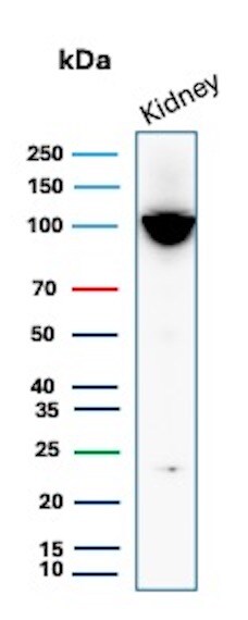 Neprilysin/CD10 Antibody (MME/6696R) Western Blot: Neprilysin/CD10 Antibody (MME/6696R) [NBP3-20611] -