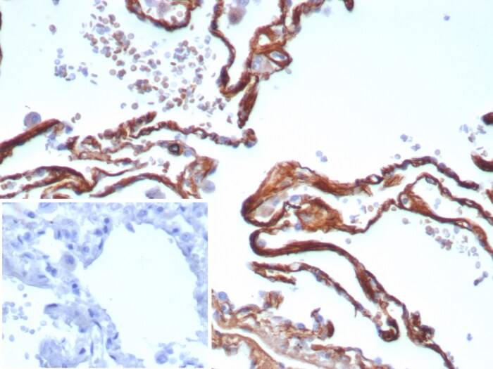 Periostin/OSF-2 Antibody (POSTN/8523R) Periostin/OSF-2 Antibody (POSTN/8523R) - Azide and BSA Free