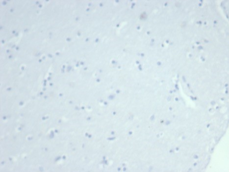 Cytokeratin 14 Antibody (rKRT14/7368)