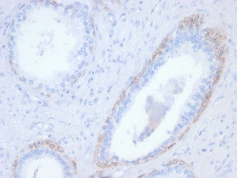 Cytokeratin 14 Antibody (rKRT14/7368)