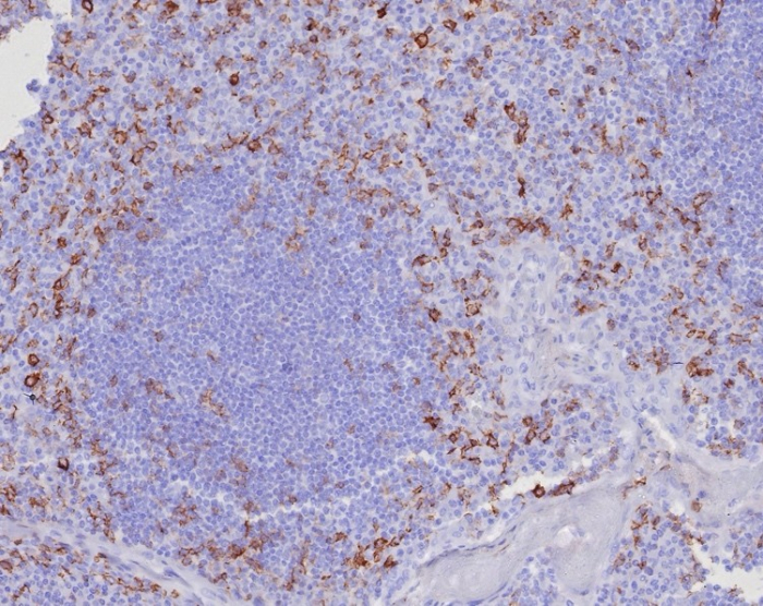 PSGL-1/CD162 Antibody (PSGL1/8135R)