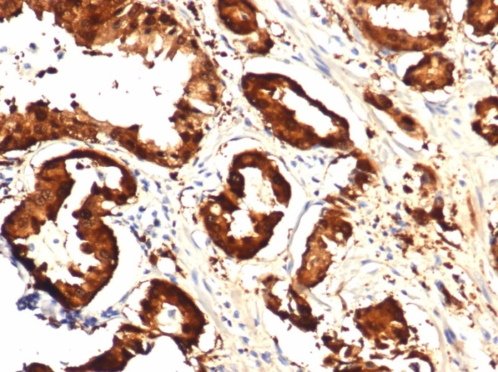 Isocitrate Dehydrogenase 1/IDH1 Antibody (IDH1.R132H/7328R)