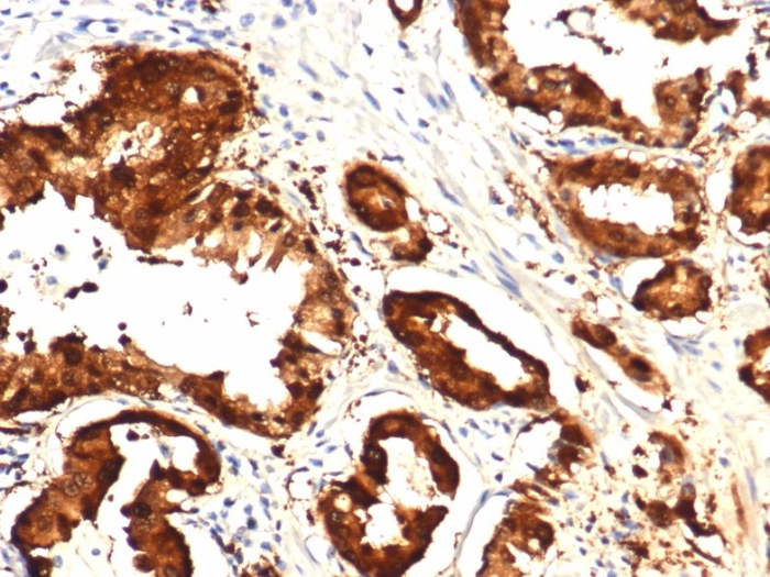 Isocitrate Dehydrogenase 1/IDH1 Antibody (IDH1.R132H/8205R)