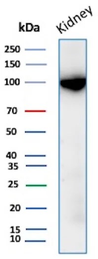 Neprilysin/CD10 Antibody (MME/8376R) Western Blot: Neprilysin/CD10 Antibody (MME/8376R) [NBP3-20635] -