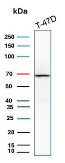 ER alpha/NR3A1 Antibody (ESR1/8407R) Western Blot: ER alpha/NR3A1 Antibody (ESR1/8407R) [NBP3-20638] -