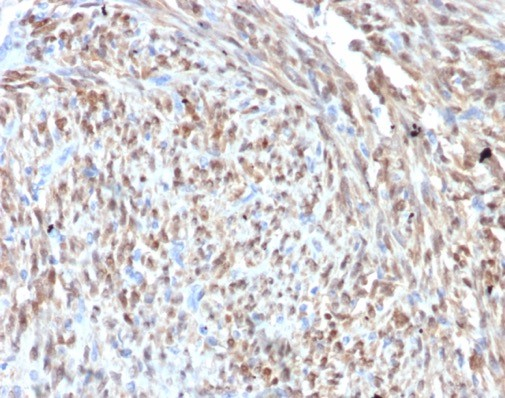 CDK4 Antibody (CDK4/7987R)