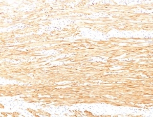 Smoothelin Antibody (SMTN/2320R)