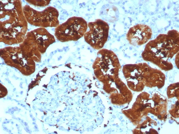 FABP1/L-FABP Antibody (FABP1/8521R)