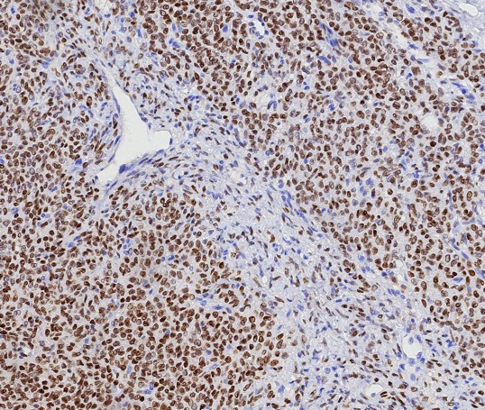 FOXL2 Antibody (FOXL2/7989R)