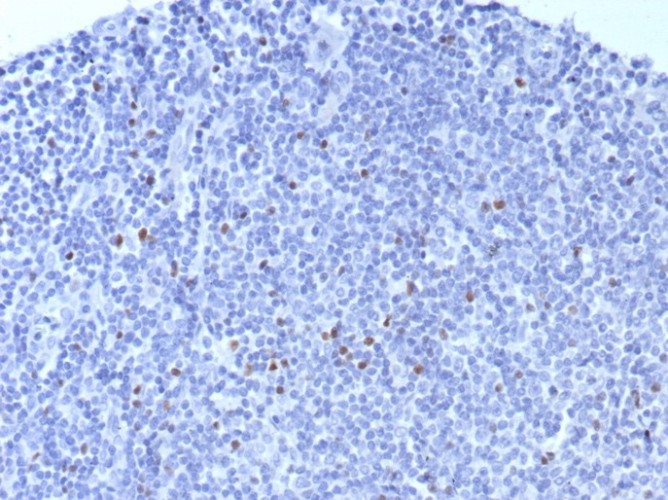 FoxP3 Antibody (FOXP3/8015R)