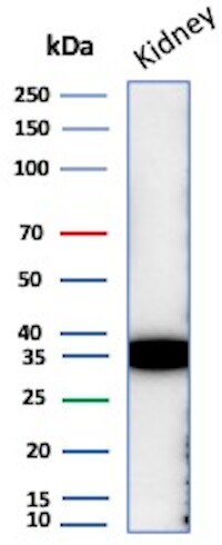 Napsin A Antibody (NAPSA/7165R) Western Blot: Napsin A Antibody (NAPSA/7165R) [NBP3-20685] -