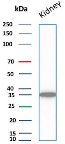 Napsin A Antibody (NAPSA/7165R) Western Blot: Napsin A Antibody (NAPSA/7165R) [NBP3-20685] -