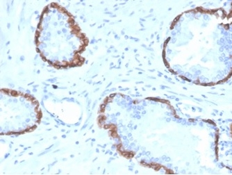 Cytokeratin 14 Antibody (KRT14/4128) - Azide and BSA Free