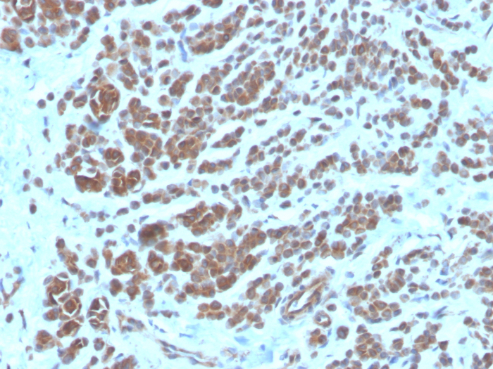 NM23-H2/NME2 Antibody (NME2/6435) - Azide and BSA Free