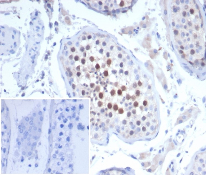 KIF2C Antibody (KIF2C/4704) - Azide and BSA Free