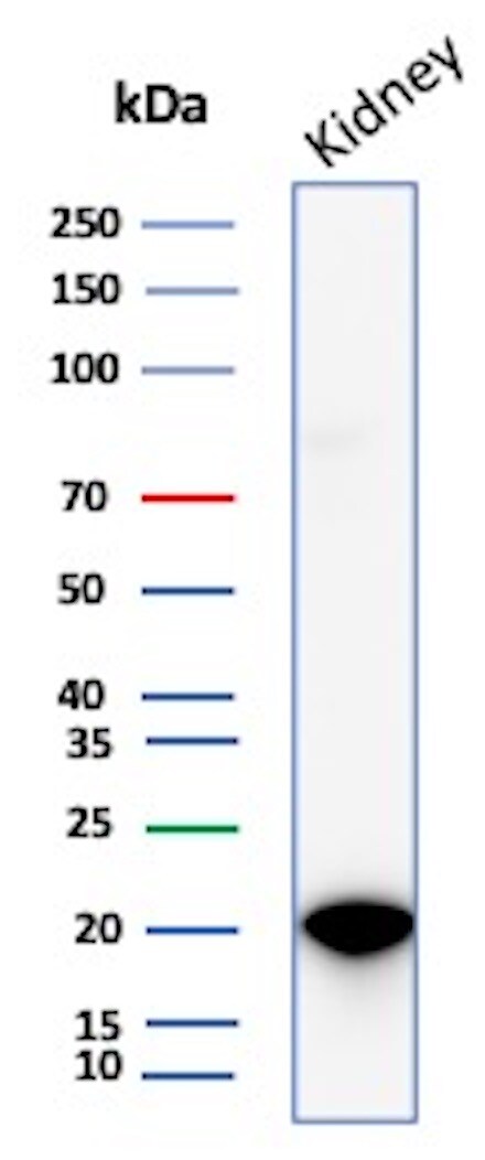 AlphaB Crystallin/CRYAB Antibody (CRYAB/4665) - Azide and BSA Free Western Blot: AlphaB Crystallin/CRYAB Antibody (CRYAB/4665) - Azide and BSA Free [NBP3-20770] -