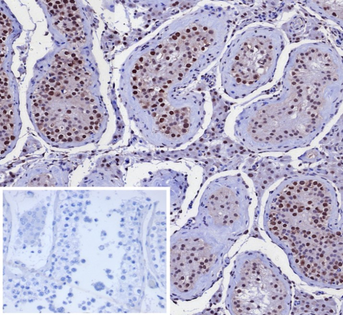 KIF2C Antibody (KIF2C/4707) - Azide and BSA Free