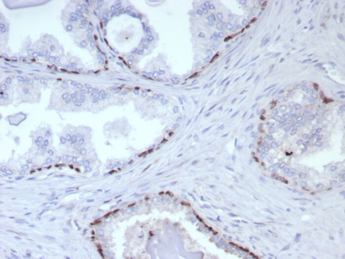 p63/TP73L Antibody (rP40/8765) - Azide and BSA Free p63/TP73L Antibody (rP40/8765) - Azide and BSA Free