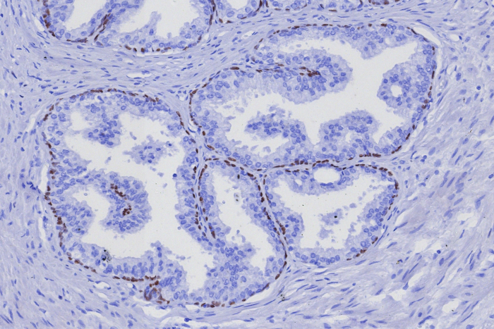 p63/TP73L Antibody (TP63/7807R) - Azide and BSA Free