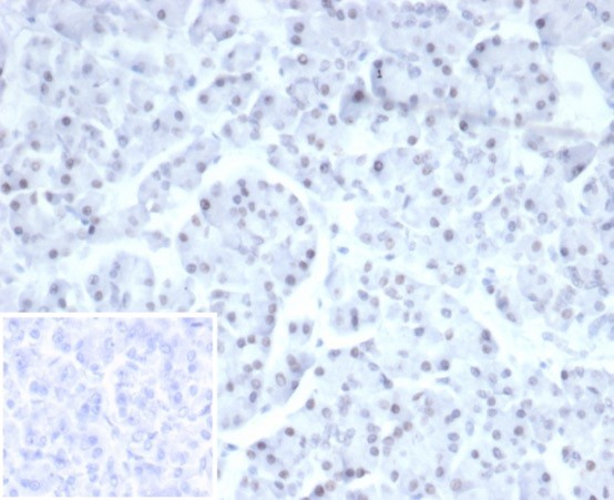 PHOX2B Antibody (PHOX2B/7161R) - Azide and BSA Free