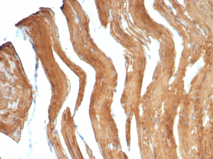 Myosin heavy chain 11 Antibody (MYH11/7610R) - Azide and BSA Free
