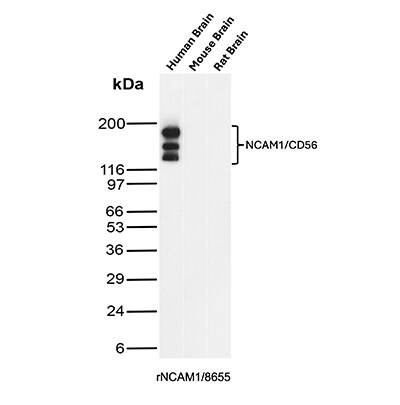 NCAM-1/CD56 Antibody (rNCAM1/8655) - Azide and BSA Free Western Blot: NCAM-1/CD56 Antibody (rNCAM1/8655) - Azide and BSA Free [NBP3-20806] -