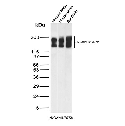 NCAM-1/CD56 Antibody (rNCAM1/8758) - Azide and BSA Free Western Blot: NCAM-1/CD56 Antibody (rNCAM1/8758) - Azide and BSA Free [NBP3-20807] -